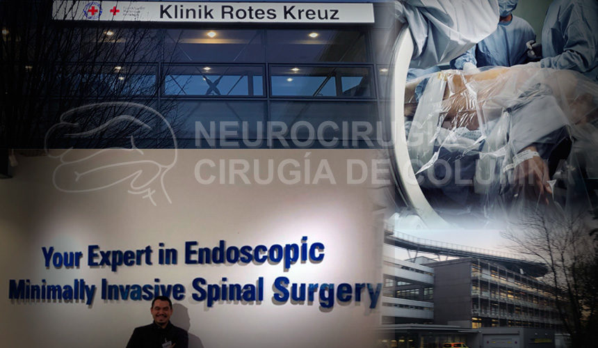Curso avanzado de cirugía ultraminimamnet invasiva endosopica de columna vertebral en Alemania